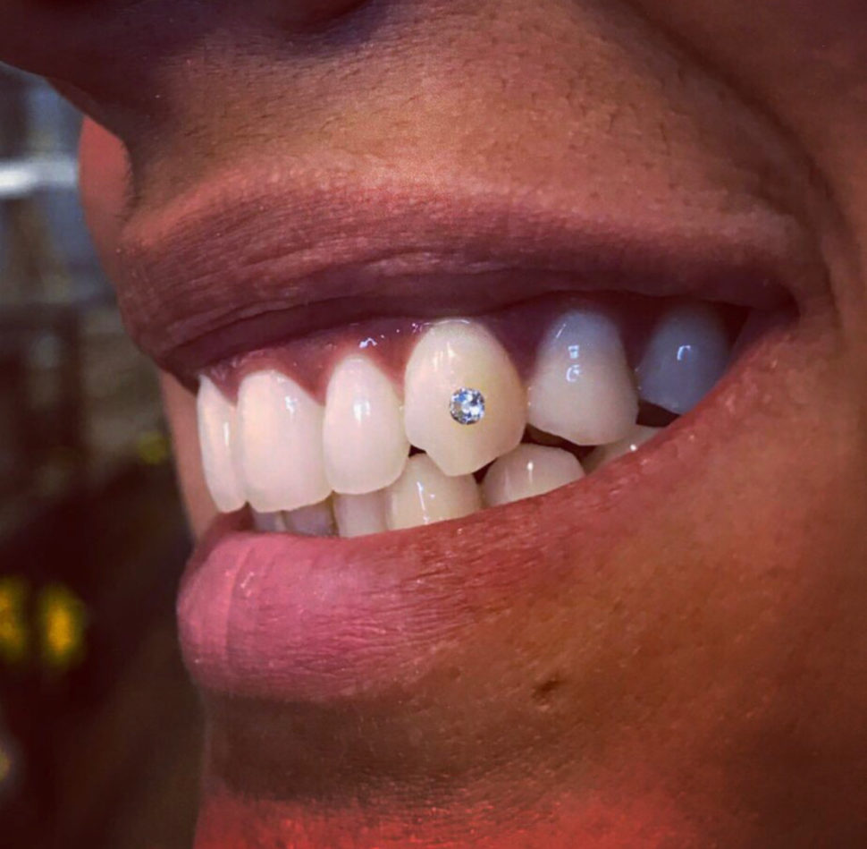 Swarovski Tooth Crystals